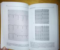Быстрый анализ ЭКГ — Хан Габриэль М. #7
