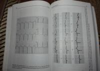 Быстрый анализ ЭКГ — Хан Габриэль М. #12