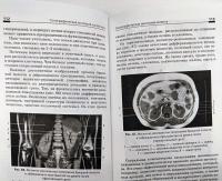 Топографическая анатомия. Учебное пособие — Елена Викторовна Чаплыгина, Виктор Иосифович Домбровский, Ольга Антониновна Каплунова, Александр Андреевич Швырев #17