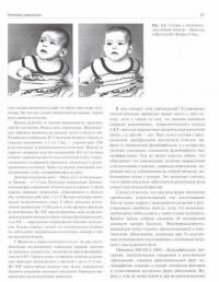 Эпилепсия у детей и взрослых женщин и мужчин. Руководство для врачей — Владмир Алексеевич Карлов #2