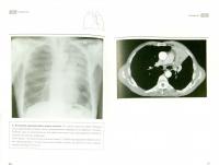 Рентгенография грудной клетки — Джонатан Корн, Кейт Пойнтон #1