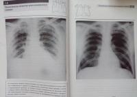 Рентгенография грудной клетки — Джонатан Корн, Кейт Пойнтон #5