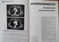 Рентгенография грудной клетки — Джонатан Корн, Кейт Пойнтон #6