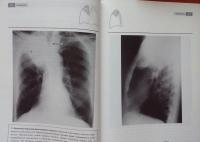 Рентгенография грудной клетки — Джонатан Корн, Кейт Пойнтон #7