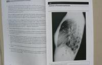 Рентгенография грудной клетки — Джонатан Корн, Кейт Пойнтон #9