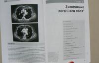 Рентгенография грудной клетки — Джонатан Корн, Кейт Пойнтон #10