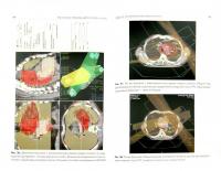 Рак легкого. Клиника, диагностика, лечение — Наталья Евгеньевна Чернеховская, Василий Иванович Борисов, Александр Викторович Столбовой, Евгений Васильевич Кижаев #1