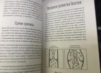 Отеки, варикоз, тромбоз и другие болезни вен. Как лечить и предотвратить — Ксения Бутова #3