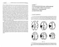 Клинические исследования нейропсихоанализе. Введение в глубинную нейропсихологию — Карен Каплан-Солмз, Марк Солмз #2