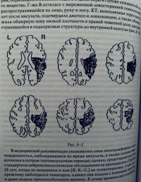 Клинические исследования нейропсихоанализе. Введение в глубинную нейропсихологию — Карен Каплан-Солмз, Марк Солмз #10